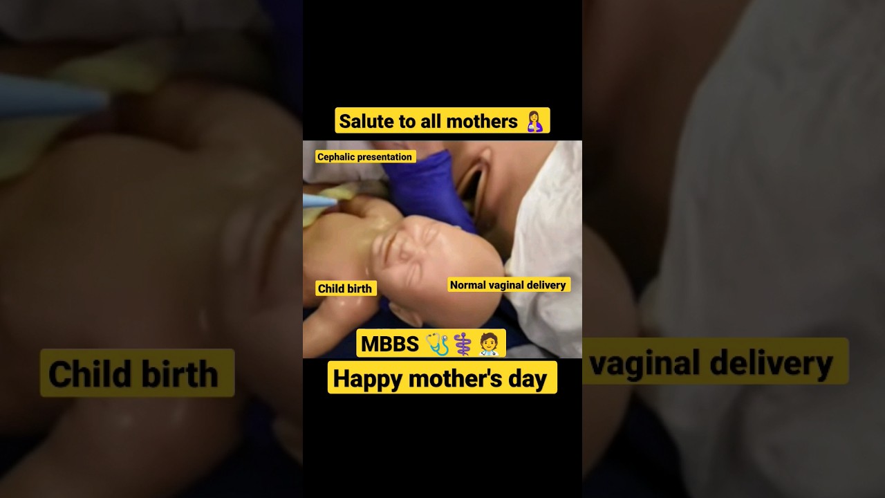 Vaginal delivery|| #shorts #mom #mothersday #mbbs #neet #health #healthtips #women ||Secret Medico